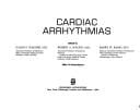 Cardiac arrhythmias