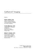 Gallium-67 imaging