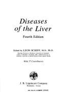 Diseases of the liver