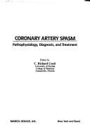 Coronary artery spasm
