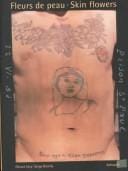 Fleurs de peau =