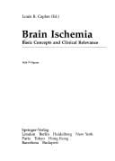 Brain Ischemia