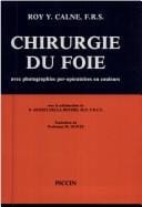 Liver surgery, with operative color illustrations