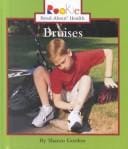 Bruises