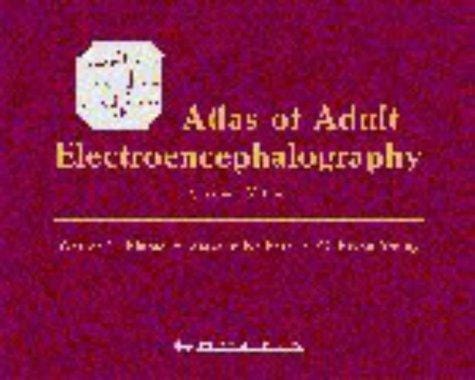 Atlas of adult electroencephalography
