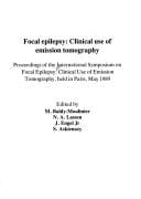 Focal epilepsy