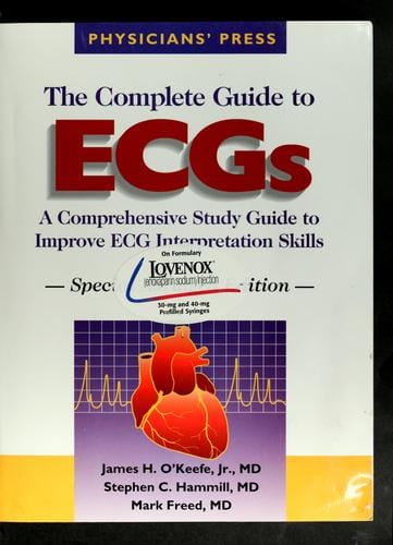 The complete guide to ECGs