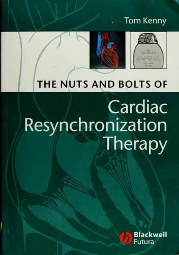 The nuts and bolts of cardiac resynchronization therapy