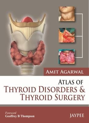 Atlas Of Thyroid Disorders And Thyroid Surgery