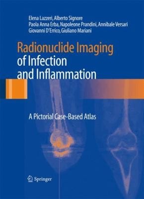 Radionuclide Imaging Of Infection And Inflammation A Pictorial Casebased Atlas