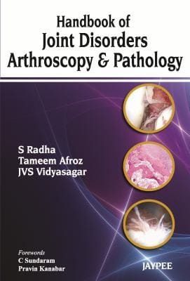Synovium The Arthroscopy And Pathology