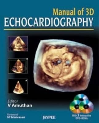 Manual Of 3d Echocardiography