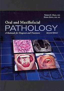 Oral and maxillofacial pathology : a rationale for diagnosis and treatment