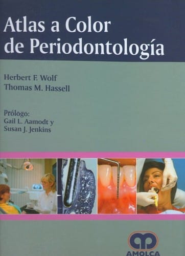 Atlas a color de periodontologia