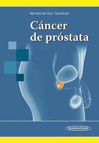 Cáncer de próstata