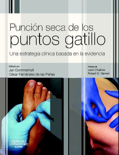 Punción seca de los puntos gatillo : una estrategia clínica basada en la evidencia