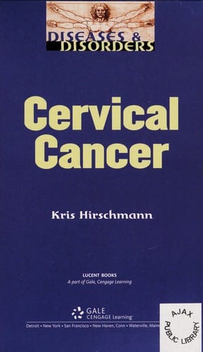 Cervical cancer