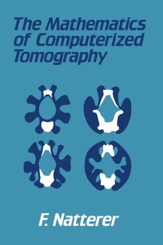 The Mathematics of Computerized Tomography (German Edition)