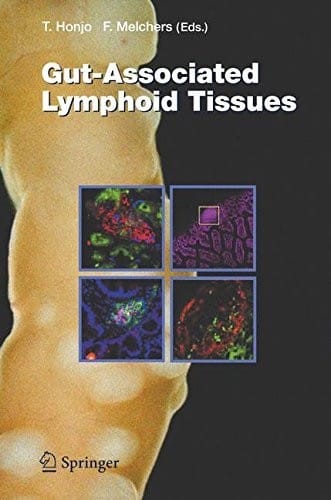 Gut-Associated Lymphoid Tissues (Current Topics in Microbiology and Immunology Book 308)