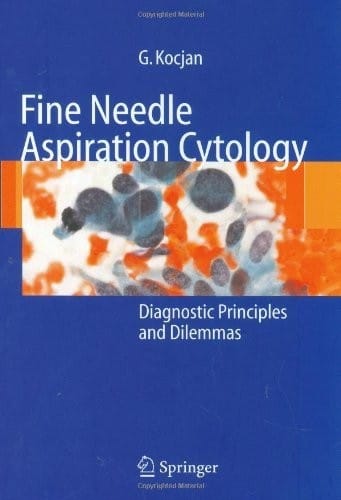 Fine Needle Aspiration Cytology: Diagnostic Principles and Dilemmas