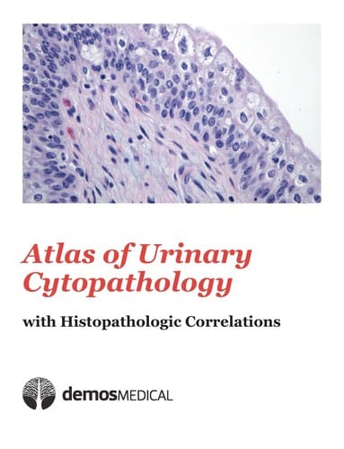 Atlas of urinary cytopathology with histopathologic correlations