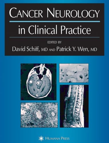 Cancer neurology in clinical practice