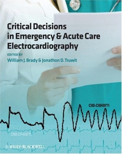 Critical decisions in emergency and acute care electrocardiography