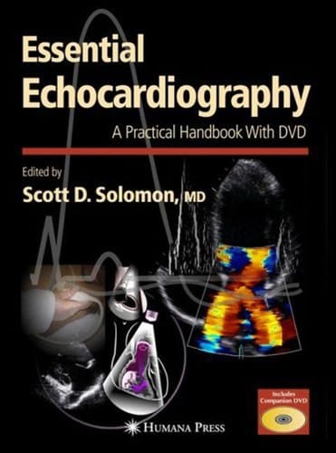 Essential echocardiography