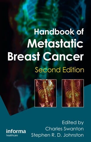 Handbook of metastatic breast cancer