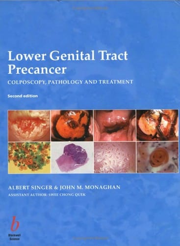 Lower genital tract precancer
