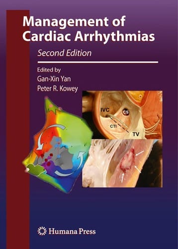 Management of cardiac arrhythmias