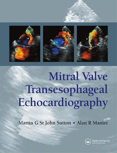Mitral Valve Transesophageal Echocardiography