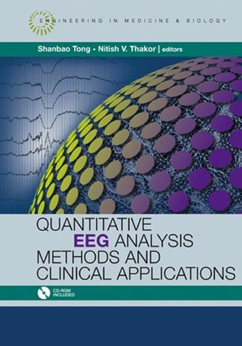Quantitative EEG analysis methods and clinical applications