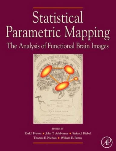 Statistical parametric mapping