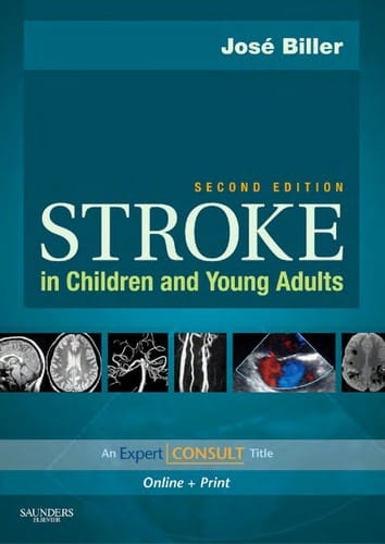 Stroke in children and young adults