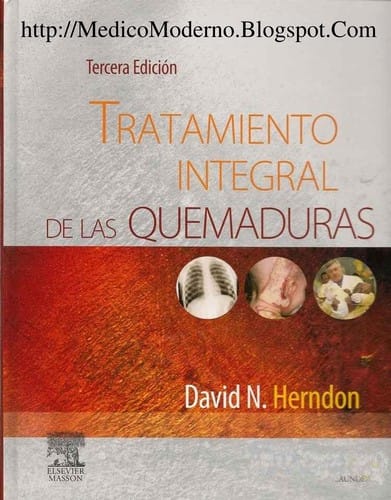 Tratamiento integral de las quemaduras