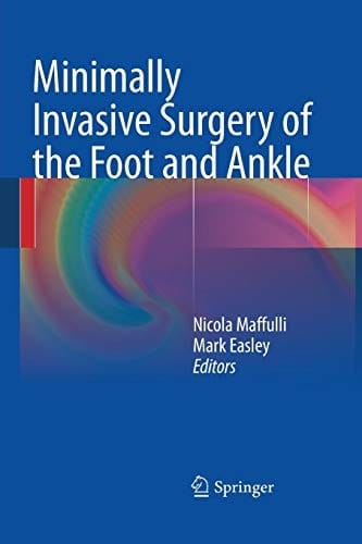 Minimally Invasive Surgery of the Foot and Ankle