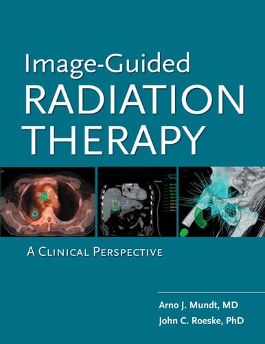 Image-guided radiation therapy