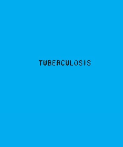Tuberculosis