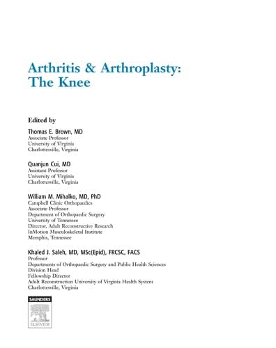 Arthritis & arthroplasty