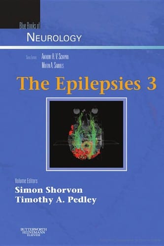 The epilepsies 3