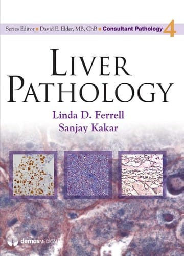 Liver pathology