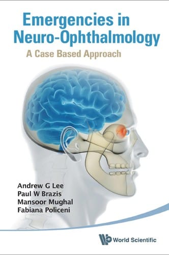 Emergencies in neuro-ophthalmology