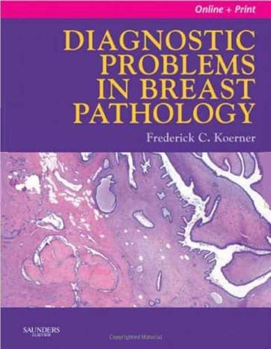 Diagnostic problems in breast pathology