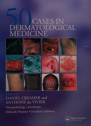 FIFTY CASES IN DERMATOLOGICAL MEDICINE