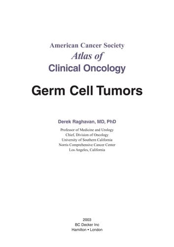 Germ cell tumors