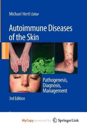 Autoimmune Diseases of the Skin: Pathogenesis, Diagnosis, Management