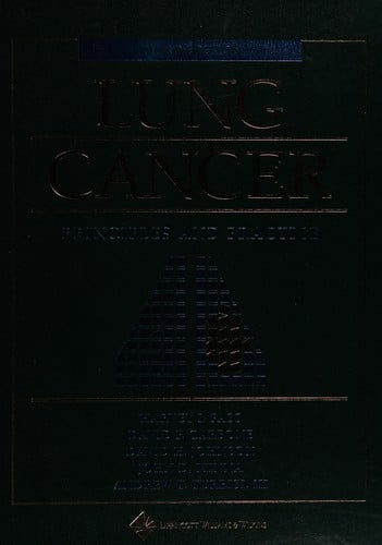 Lung cancer: principles and practice
