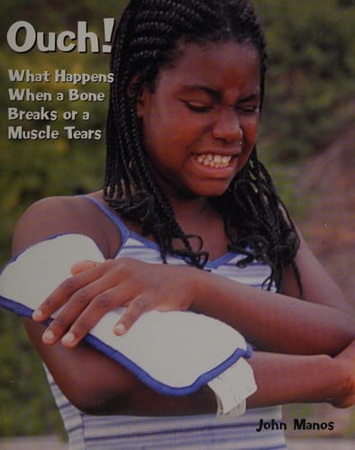 Ouch!: What happens when a bone breaks or a muscle tears