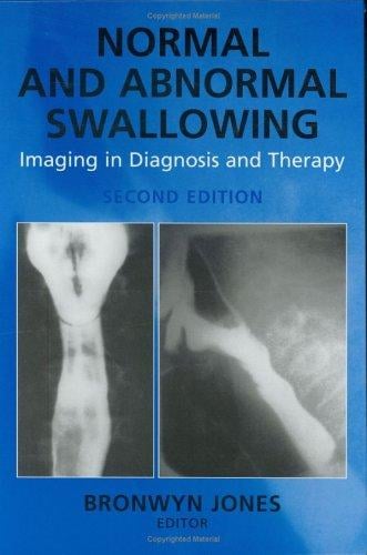 Normal and Abnormal Swallowing